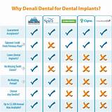 Dental Insurance With No Missing Tooth Clause Pictures
