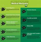 Pros Of Medical Marijuana Photos