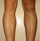 Why Do Soccer Players Shave Their Legs Pictures
