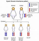 Cystic Fibrosis Gene Carrier