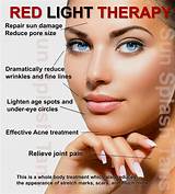 Photos of Red Light Therapy Benefits