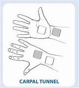 Best Pain Medication For Carpal Tunnel