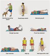 Exercises Knee Osteoarthritis Pictures