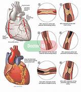 Artery Doctor Images