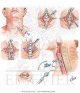 Images of Medical Illustrations For Sale