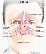 Medication For Swollen Nasal Passages Pictures
