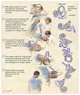Photos of Labyrinthitis Balance Exercises