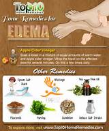 Pictures of Edema Home Remedies
