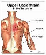 Deltoid Strain Recovery Time