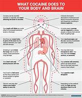 Photos of What Does Marijuana Effect On The Body