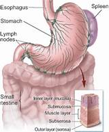 Photos of Gastric Cancer Treatment Guidelines