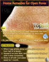 Home Remedies For Clogged Pores Pictures