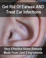 Photos of Build Up Ear Wax Home Remedies