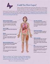 What Doctor Do You See For Fibromyalgia Photos
