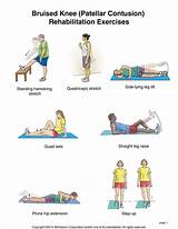 Pulled Quad Muscle Recovery Images