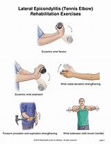 Images of Physical Therapy For Tennis Elbow Tendonitis