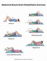 Flat Back Syndrome Treatment Exercises Photos