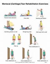 Images of Balance Exercises After Knee Surgery