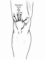 Vastus Lateralis Muscle Strengthening Pictures