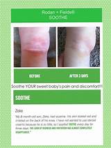 Soothe Sensitive Skin Treatment Images