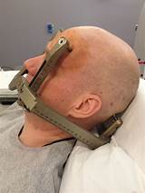 Head Frame For Gamma Knife Surgery Pictures