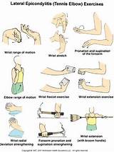 Physical Therapy For Tennis Elbow Tendonitis Photos