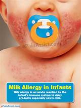 Milk Allergy Treatment Photos