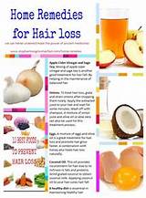 Losing Hair Home Remedies Images