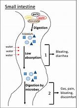 Causes Of Bloating Gas And Diarrhea Photos
