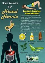 Home Remedies For Hiatal Hernia Pain Pictures