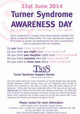 Fertility Treatment For Turner Syndrome Photos