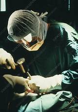Images of Hospital For Special Surgery Hip Replacement Surgeons