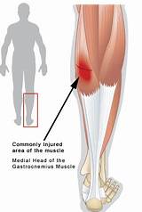 Dvt Recovery Leg Pain Pictures