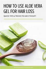 Aloe Vera For Baldness Treatment Pictures