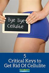Images of What Is The Best Treatment To Get Rid Of Cellulite