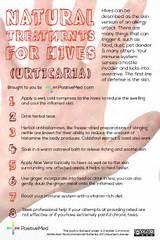 Photos of Chronic Urticaria Home Remedies
