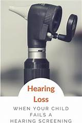 Hearing Loss Recovery Time Photos