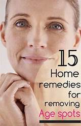 Pictures of Home Remedies For Age Spots On Face And Hands
