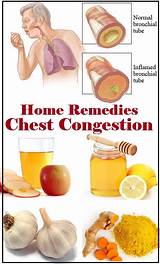 Pictures of Home Remedies Chest Cold