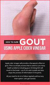 What Doctor For Gout