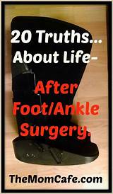 Images of Foot Fracture Surgery Recovery Time
