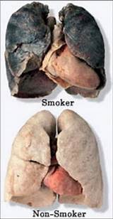 Images of Is Smoking Marijuana Bad For Your Heart