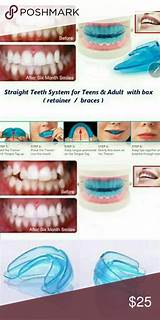 Orthodontic Teeth Straightening Photos