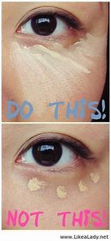 Pictures of Deep Set Eyes Dark Circles Treatment