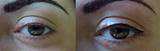 Photos of Eyelid Permanent Makeup