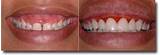Devereux Orthodontics Pictures