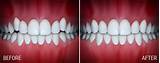 Images of Scott Orthodontics Silver Spring Md
