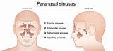 Pictures of Doctor For Sinus Problems