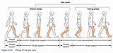 Gait Therapy Photos