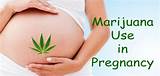 Effects Of Smoking Marijuana While Pregnant Pictures